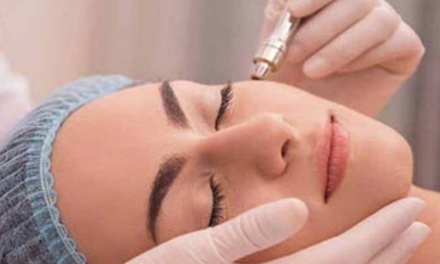 Two Microdermabrasion Treatments (45–60 Min Each) with RED Light Therapy - A Younger You Spa