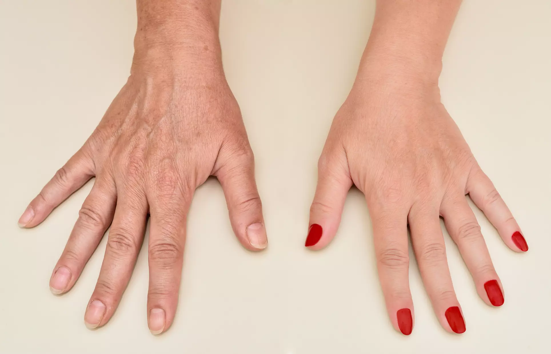 Up to 35% Off on Hand Rejuvenation at About Image Med Spa - Primary Image