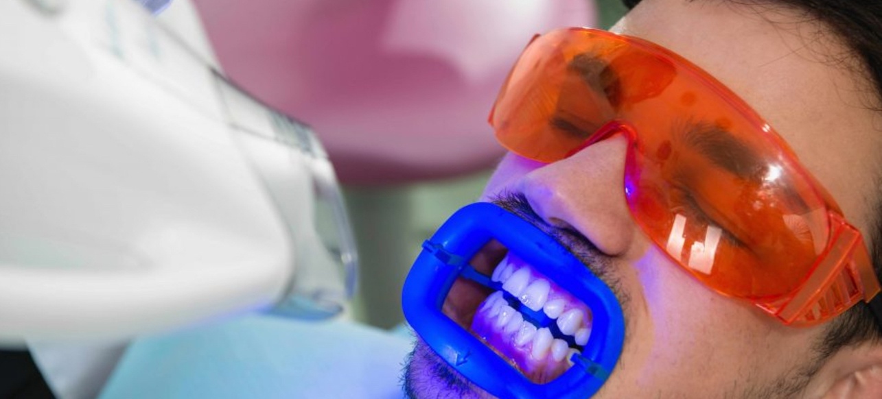 Up to 66% Off on Teeth Whitening at Whitening Central