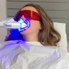 Image 4: Laser Teeth Whitening for a Brighter Smile