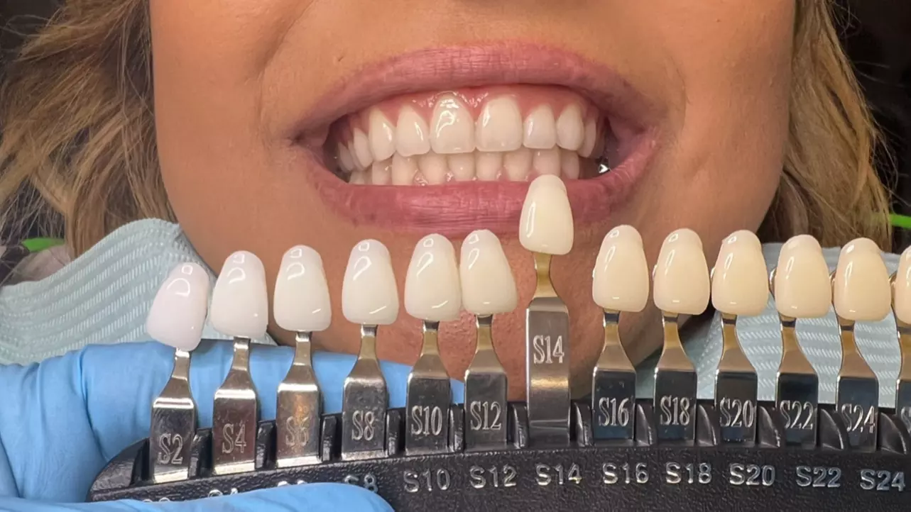 Up to 58% Off on Teeth Whitening at New Smile Cosmetics LLC - Primary Image