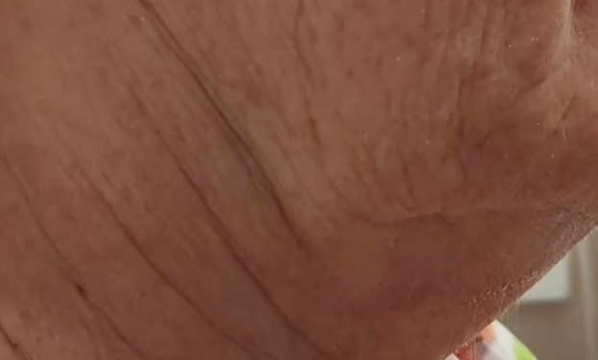 Image 2: Revitalize with a One or Two Sessions of HIFU Full Face & Neck 