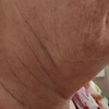 Image 2: Revitalize with a One or Two Sessions of HIFU Full Face & Neck 