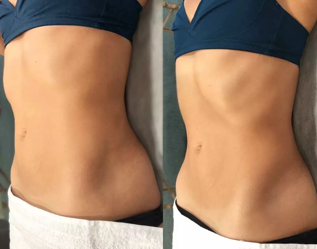 Experience Hello Gorgeous Face & Body Contouring's 60 Minute Wood Therapy with Full Body Vibration for up to 50% off - Primary Image
