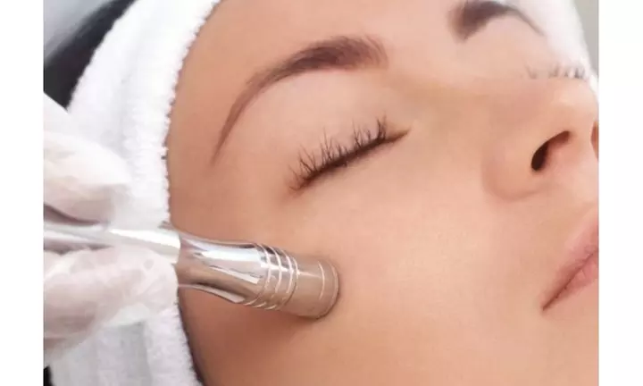 Evolve Beauty Sculpt offers microdermabrasion treatments with custom facials for up to 70% off - Primary Image