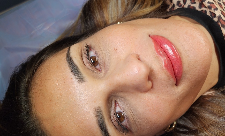 Image 4: Up to 46% Off on Lip Enhancement at Berry Lips by Jussara