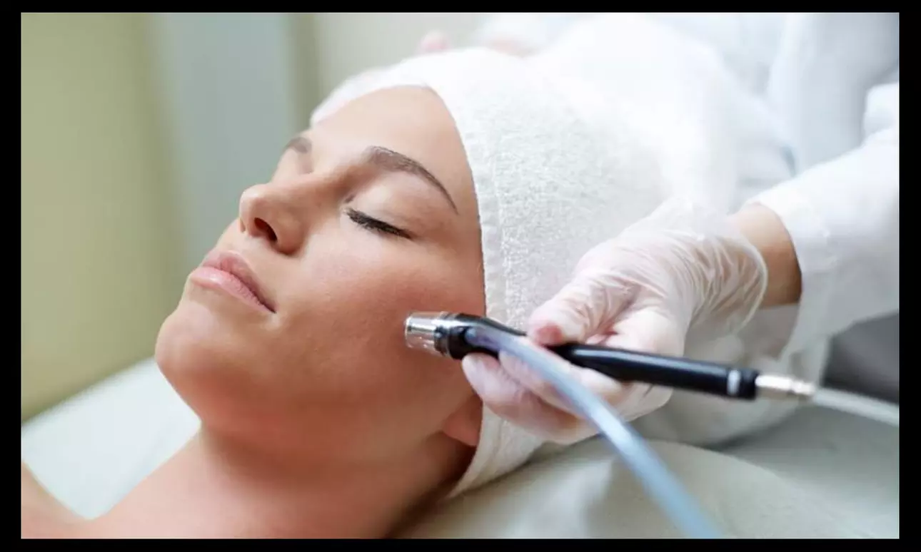 Up to 57% Off on Microdermabrasion at 912 Studio LLC - Primary Image