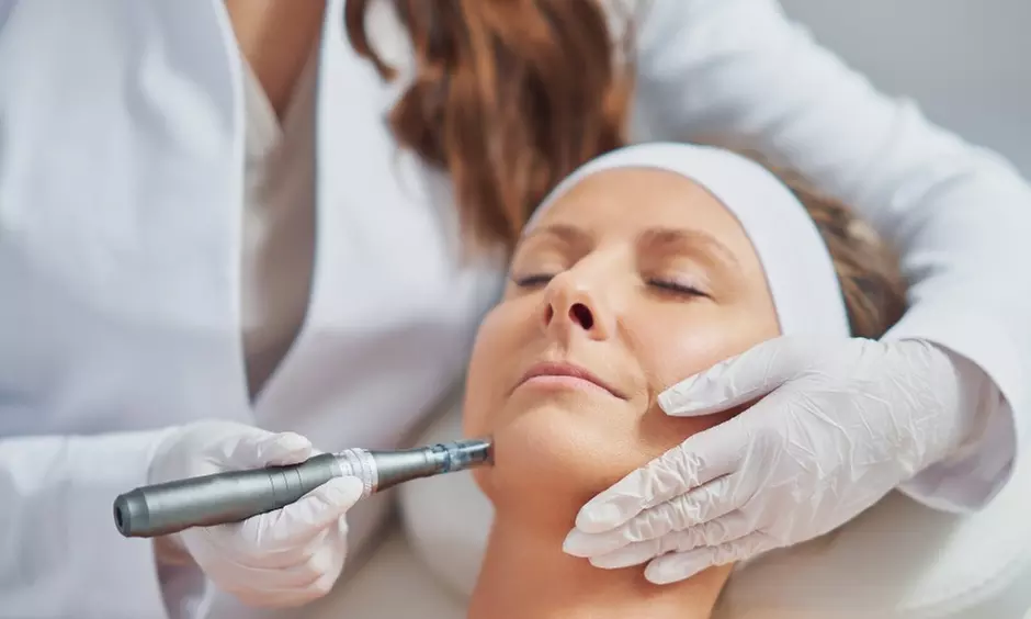 Up to 51% Off on Micro-Needling at DermaLux Medical Aesthetics - Second Medium