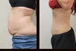 Up to 87% Off on Electrical Muscle Stimulation at Advanced Body Design & Wellness - Second Medium
