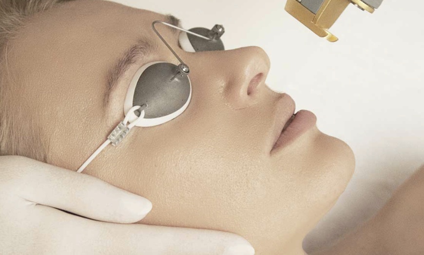 Image 1: Revitalize Your Glow: One or Two Laser Genesis Facial on Face & Neck