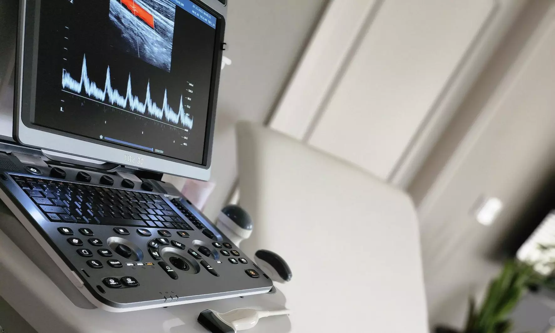 Up to 50% Off on Ultrasound at At 1st Glance - Second Medium