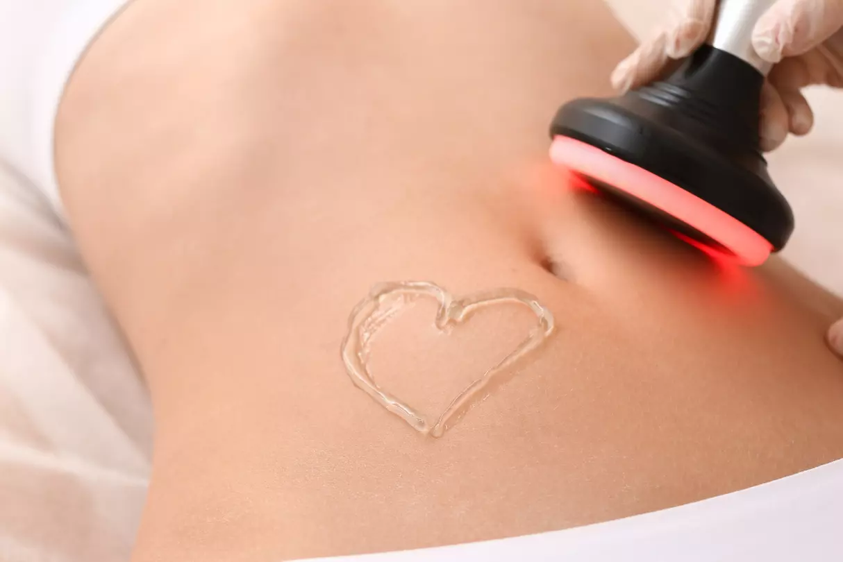 Ultrasonic Fat Cavitation Body Sculpting Sessions - Abdomen