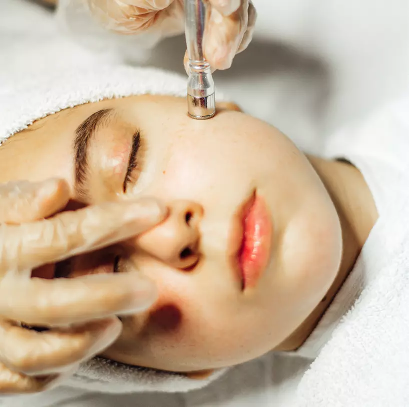 Experience smoother skin at Laser Derm Med Spa with microdermabrasion options and save up to 79% - Primary Image