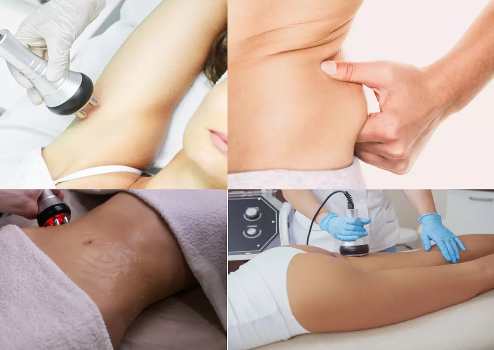 Up to 60% Off on Ultrasonic Fat Reduction at Refined Physique - Second Medium