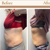 Image 4: Up to 51% Off on Cavitation at Double Take Body Studio