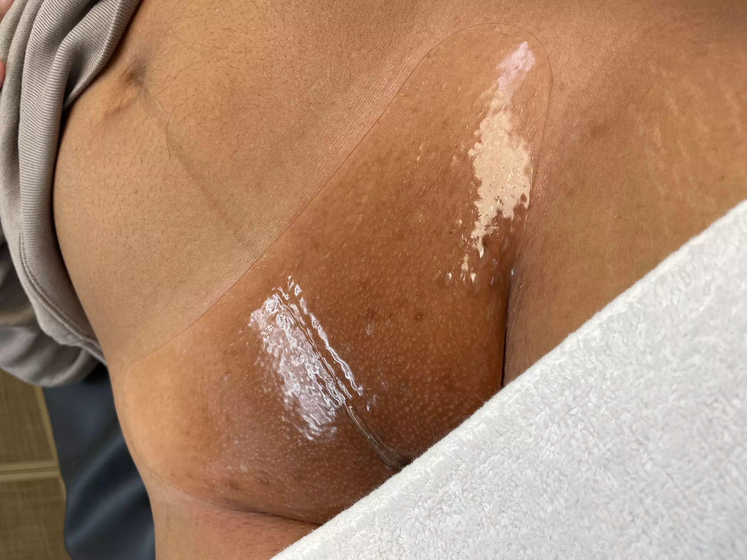Experience smooth skin with Skin Deep Aesthetics' waxing options for up to 40% off - Second Medium