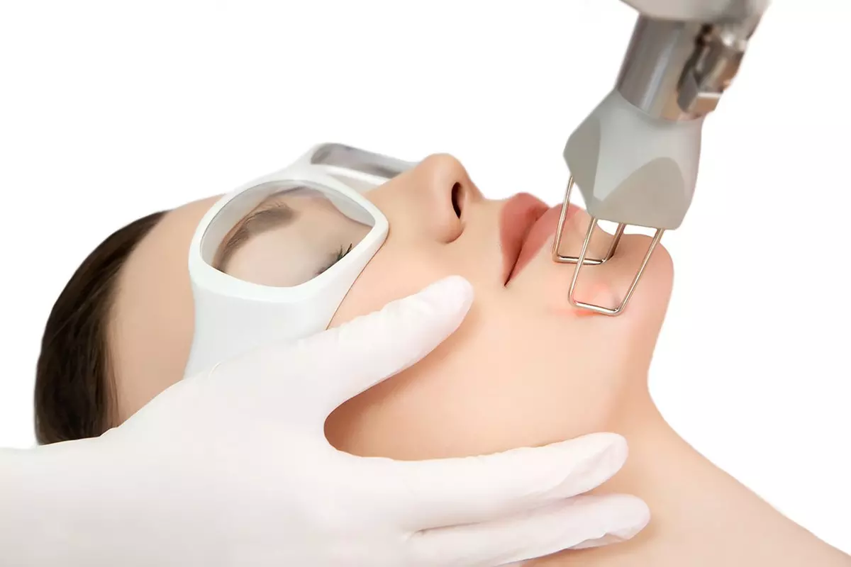 Up to 10% Off on Laser Skin Resurfacing - Fractional - Branded (Fraxel) at Andes Med Spa - Primary Image