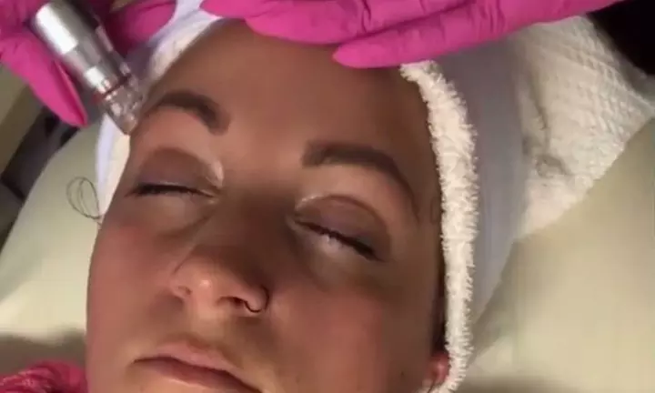 Up to 33% Off on Facial - Caviar at Pretty Lyfe Esthetics