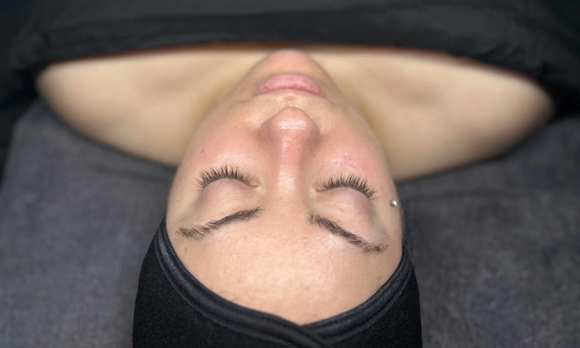 Rejuvenate Your Skin with Microdermabrasion and Facial Options
