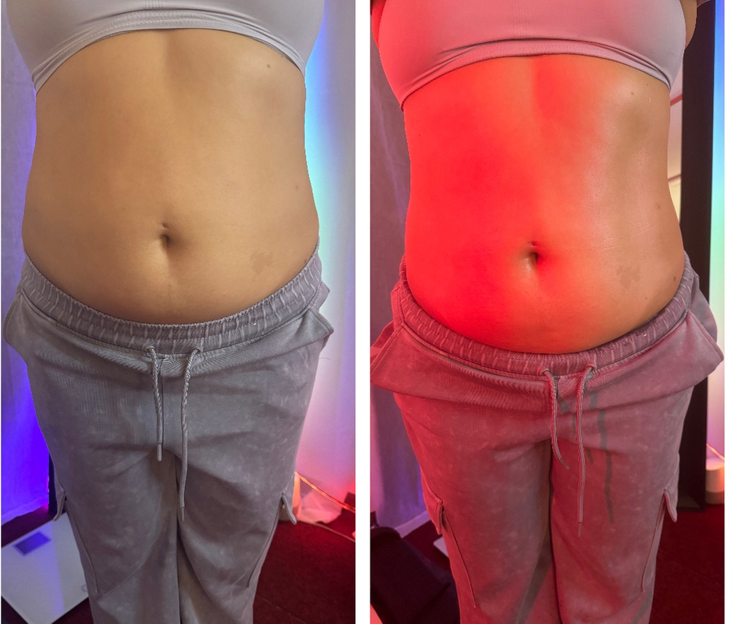 Up to 55% Off on Ultrasonic Fat Reduction at Travel Goddess Bodies