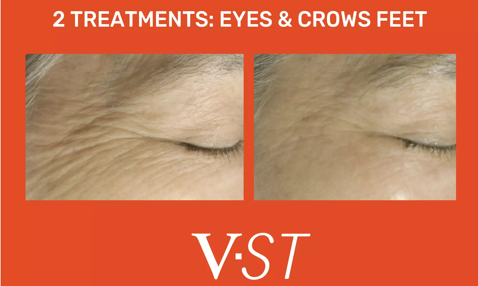 Nirvana Aesthetics And Wellness offers skin tightening on face, hands, and neck with up to 74% off - Primary Image