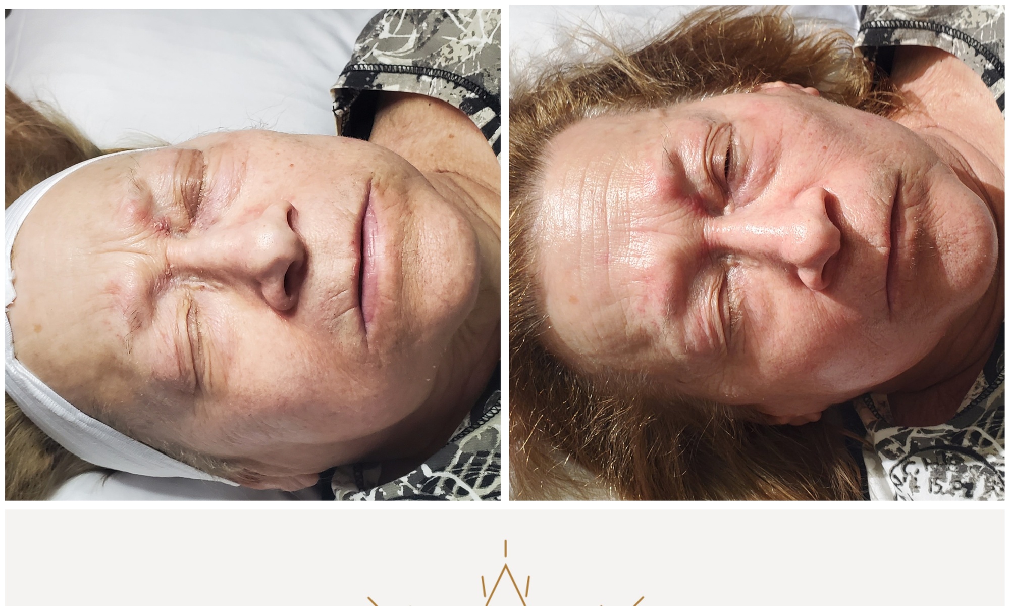 Up to 60% Off on Facial at Everglo Spa