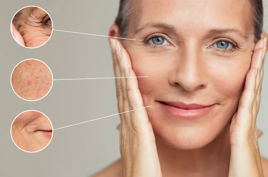 Radio Frequency Skin Tightening at Dorset Salt Therapy