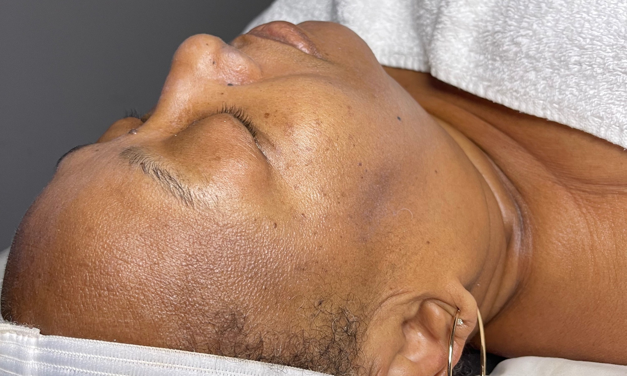 Get a Custom Facial for Every Skin Type at Massage World Medspa
