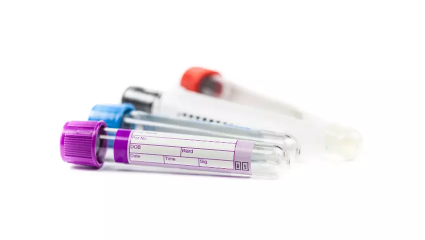 Discover phlebotomy with International Open Academy's online course and learn venipuncture, up to 89% off - Primary Image