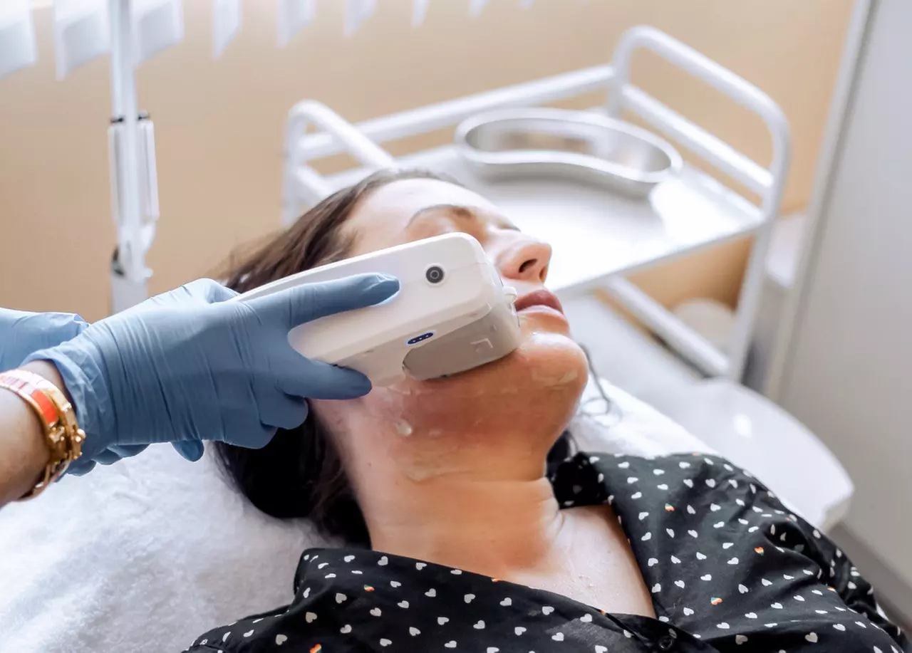 Up to 30% Off on Ultherapy / Ultrasonic Facial at Amber Beauty Lounge - Primary Image
