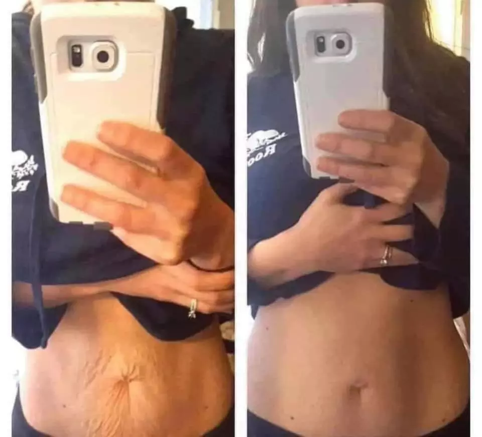 Up to 66% Off on Ultrasonic Fat Reduction at The Final Touch - Primary Image