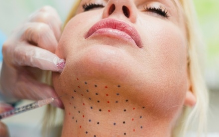 One Vial of Kybella - McLean Body Contouring and Laser Center