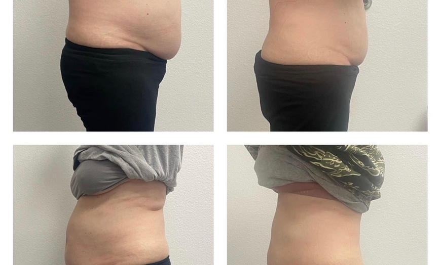 Image 3: One, Four or Eight Body Sculpting Sessions