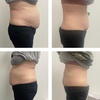 Image 3: One, Four or Eight Body Sculpting Sessions