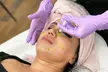 Up to 66% Off on Facial - Chemical Peel at UK Aesthetics Lounge - Image 4