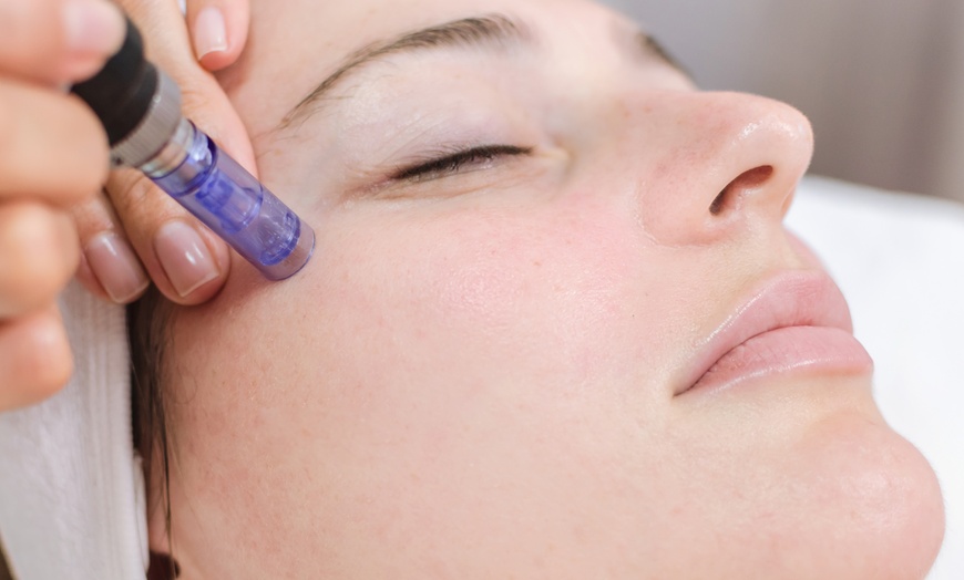 Image 2: Microneedling- oder Aqua-Facial-Behandlung für das Gesicht