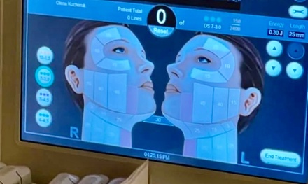 Ultherapy Treatment for Under Eyes - Enigma Medi Spa & Laser Center