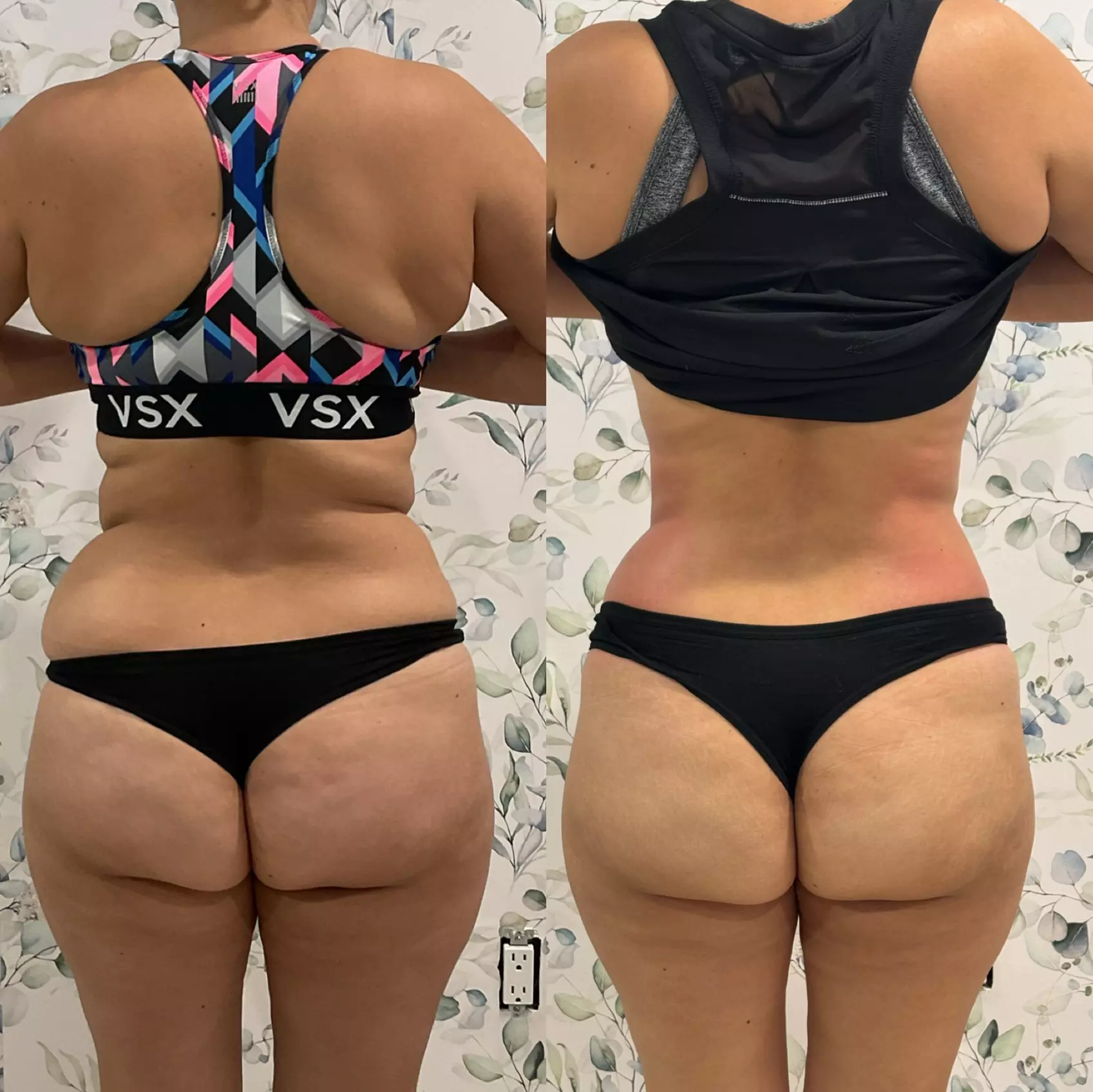 Up to 51% Off on Ultrasonic Fat Reduction at Soleil med spa