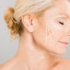 Image 4: Up to 64% Off on Facelift - Thread Lift at DermAlign Medical Aesthetics