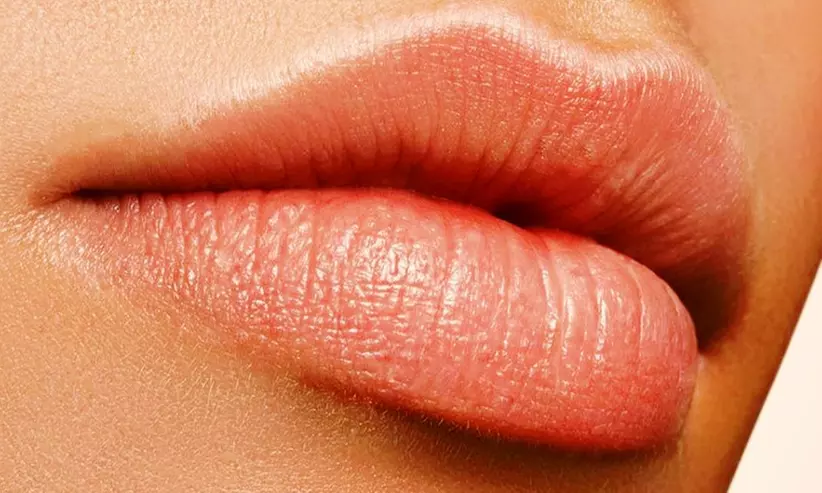 Up to 43% Off on Injection - Dermal Filler at Tulip Medical Aesthetics - Primary Image
