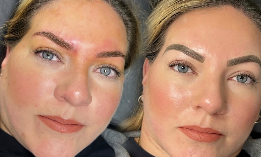 Image 2: Up to 30% Off on Microblading at YouLuvBrows