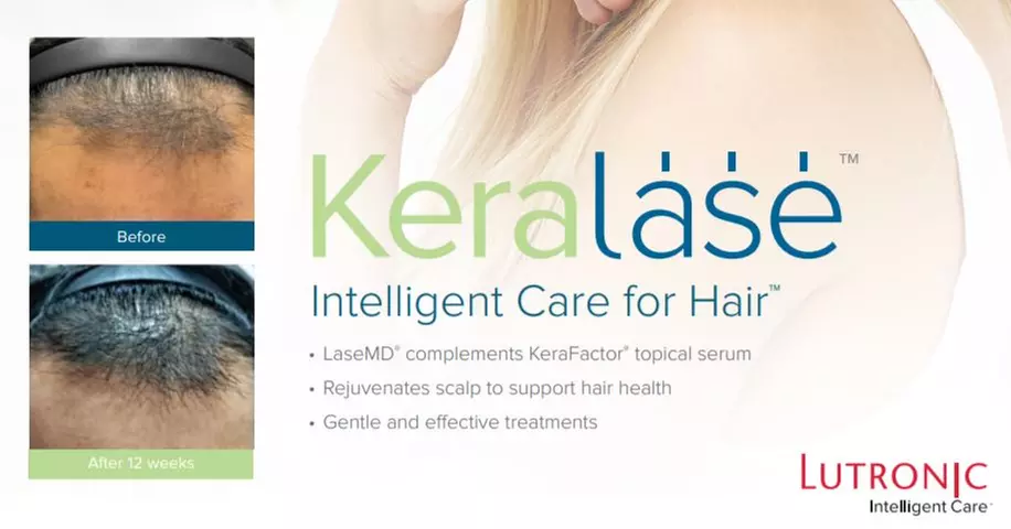 Up to 85% Off on Laser Hair Restoration at Mirelle Institute for Anti-Aging Medicine - Primary Image