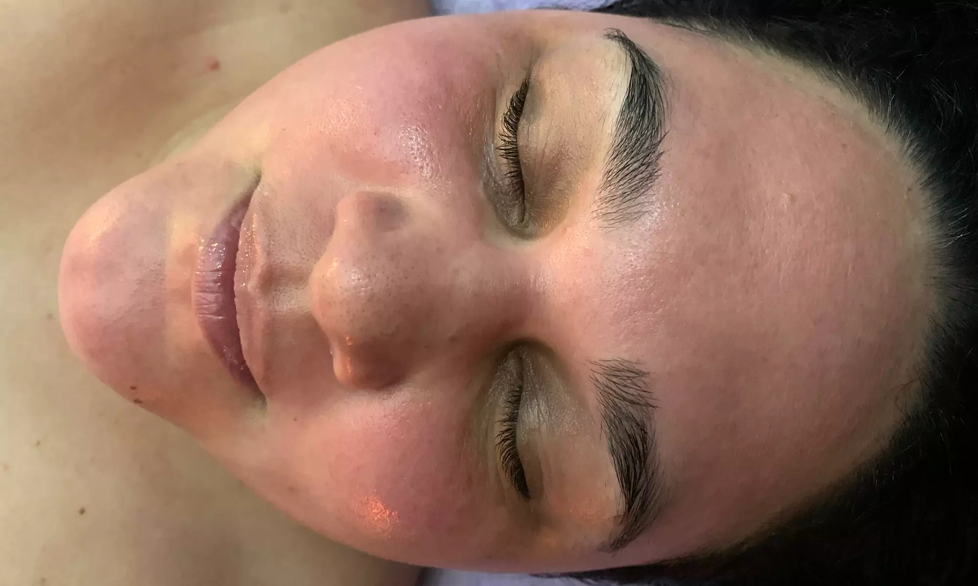 Up to 47% Off on Microdermabrasion at Aesthetic Alchemy - Primary Image