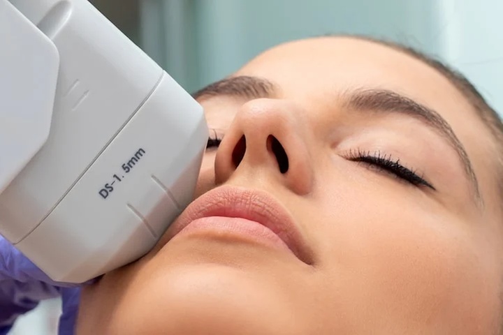 Up to 60% Off on HIFU 5D Non-Invasive Facelift