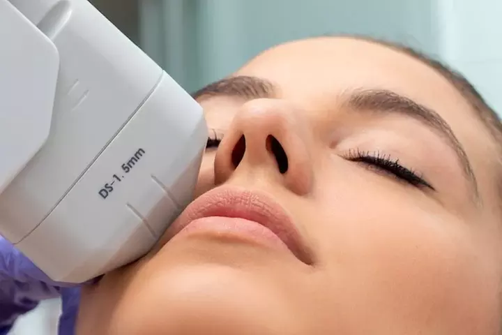 Up to 60% Off on HIFU 5D Non-Invasive Facelift