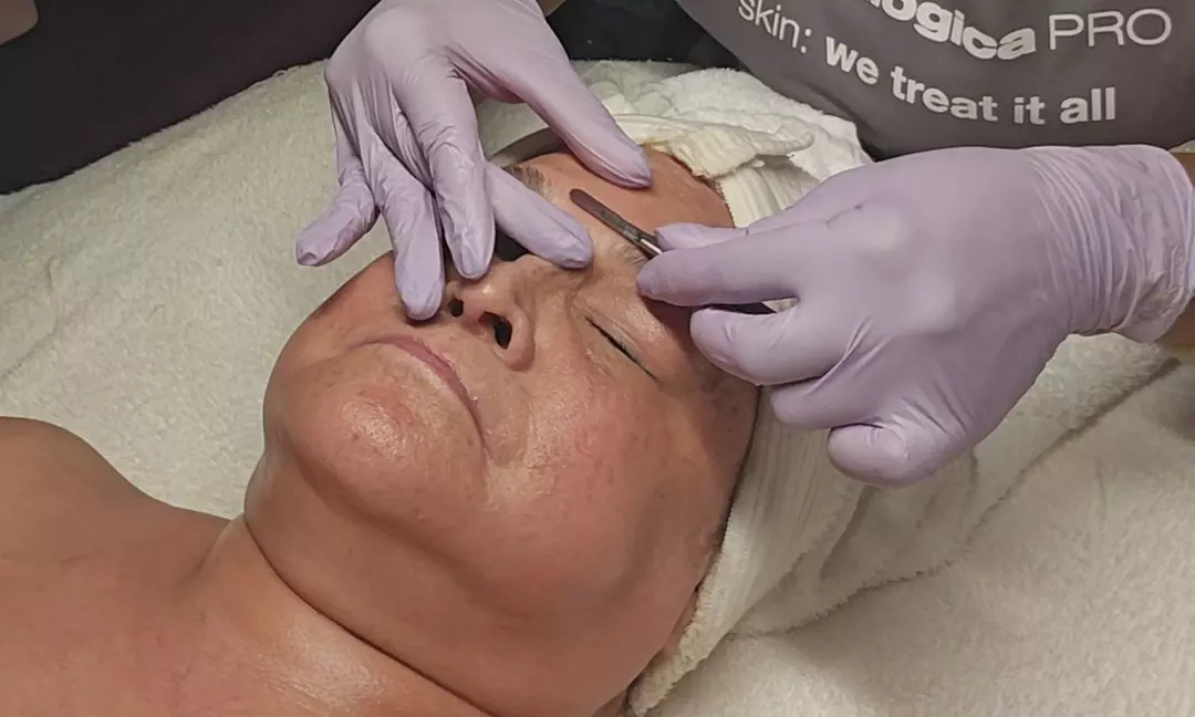 One, Three or Five 60-Min Customized or Dermaplane Facials