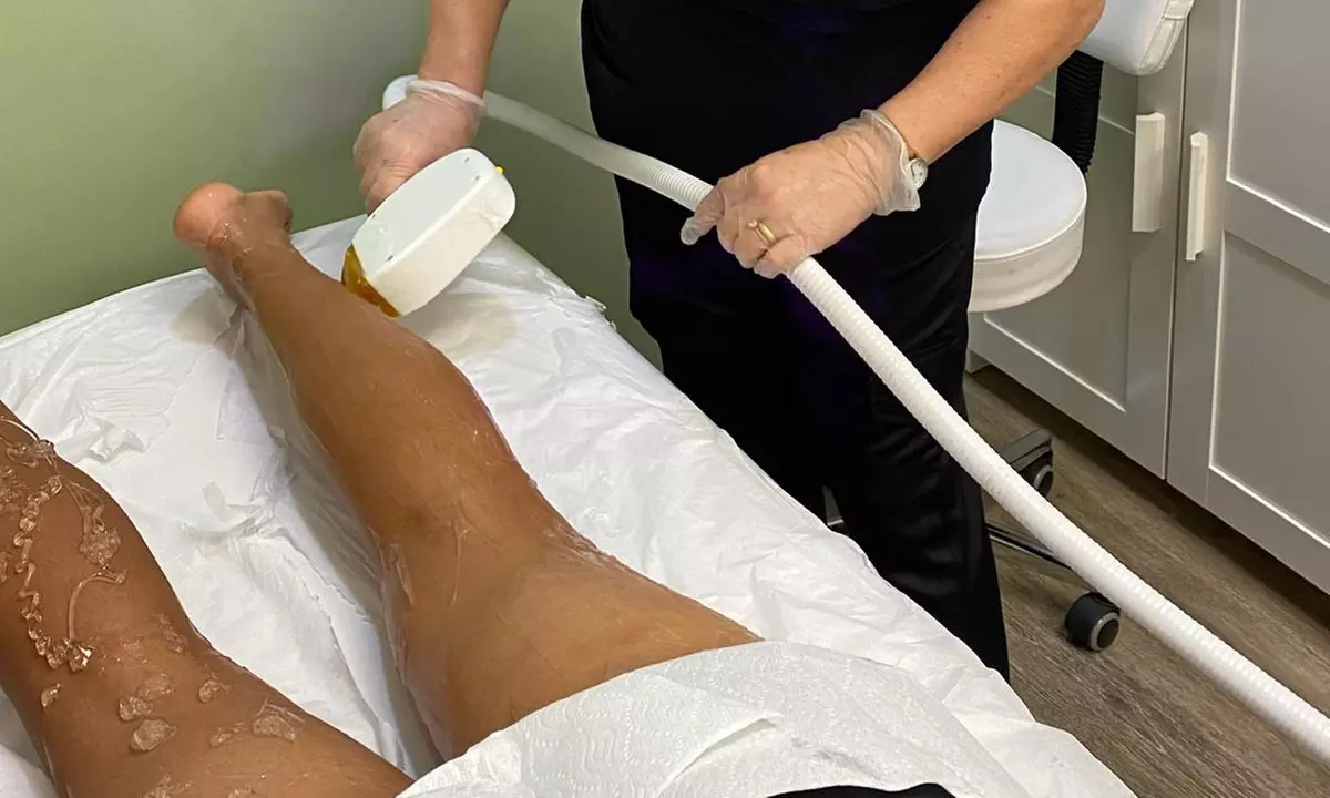 Six Laser Hair-Removal Sessions on Various Areas