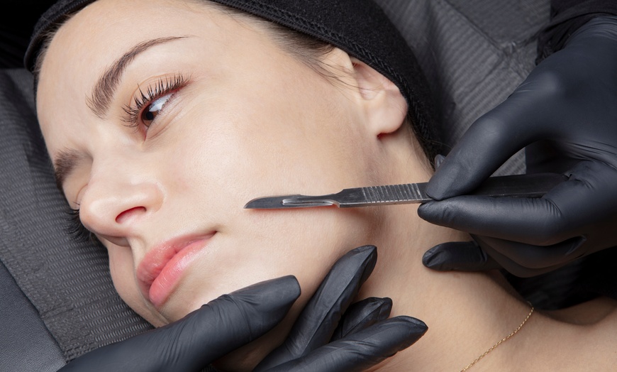 Image 2: 60 & 90-Min Facials & Peels for Brighter, Smoother Skin