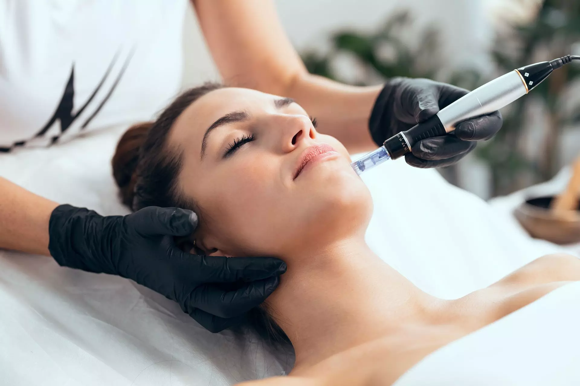 Up to 71% Off on Micro-Needling at Loma Laser