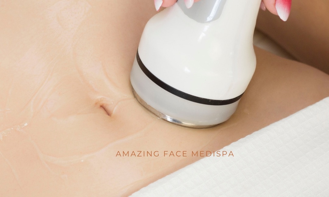 Up to 68% Off on Radio Frequency Skin Tightening at Amazing Face Medi-Spa - Primary Image